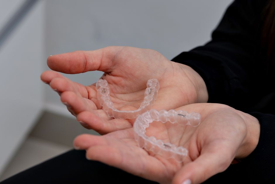 Can Clear Aligners Fix an Overbite? Florence, SC Guide